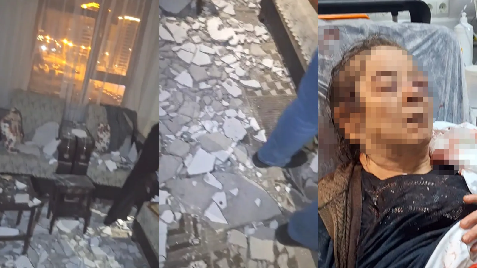 Evinde otururken tavan başına çöktü: 75 yaşındaki kadın görme kaybı yaşadı!